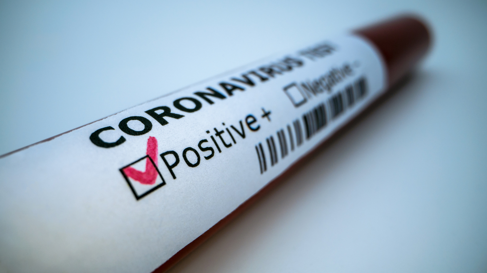 Govt Sees Fresh Covid Cases & Positivity Rates Plateauing